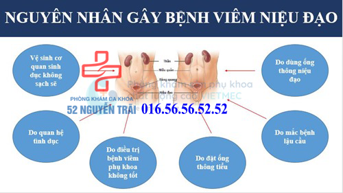 Nguyen-nhan-viem-nieu-dao-1